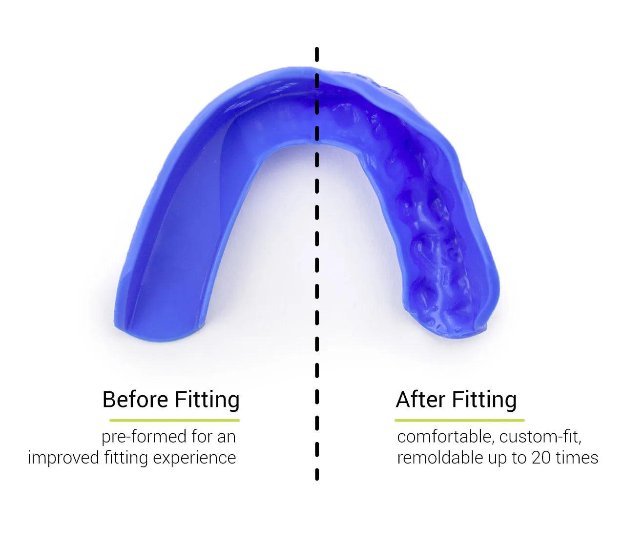SISU 3D Protector Bucal